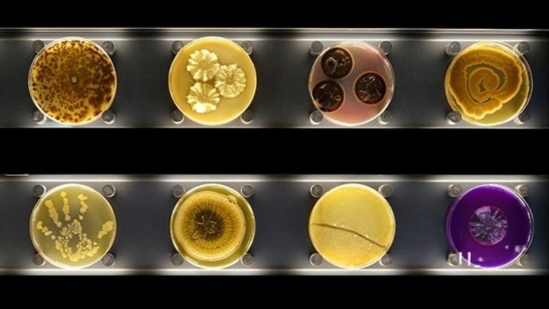 Petri dishes containing different micro-organisms at Amsterdam Artis Zoo